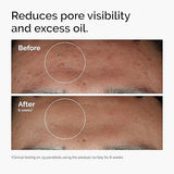The Ordinary Niacinamide 10 % + Zinc 1 % Serum 30 ml